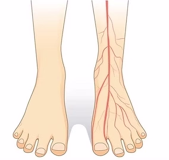 Poor blood circulation