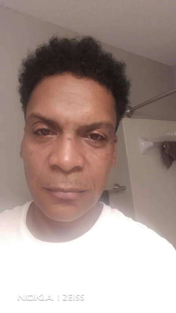 best shampoo for thinning hair